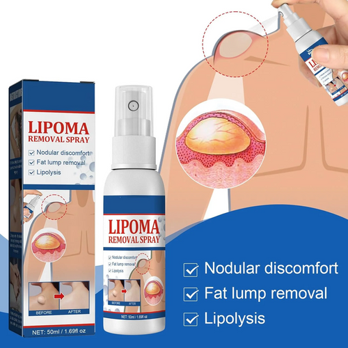 NOUVEAU SPRAY LIPOMA™