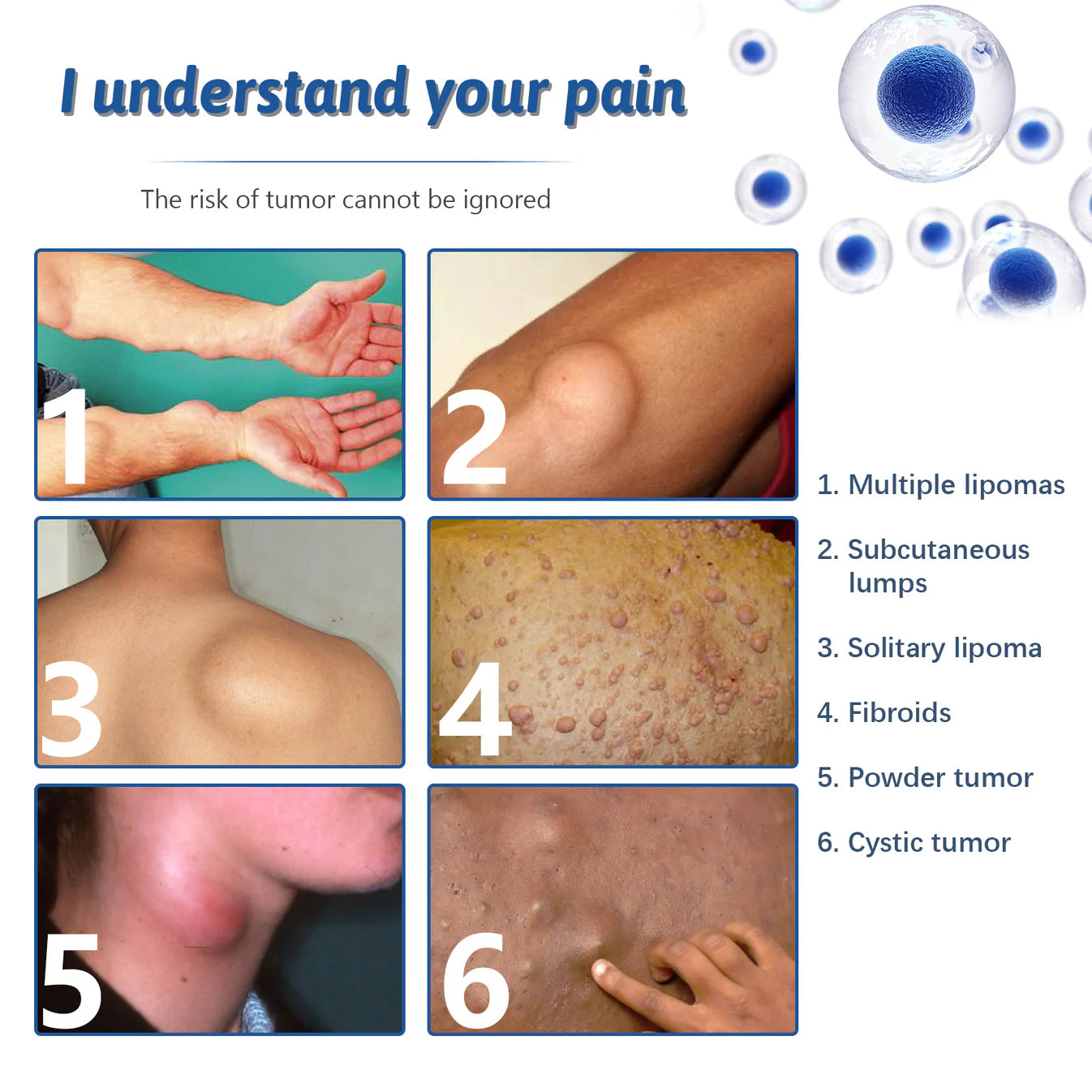 NOUVEAU SPRAY LIPOMA™