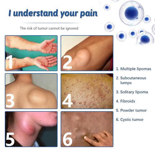 NOUVEAU SPRAY LIPOMA™